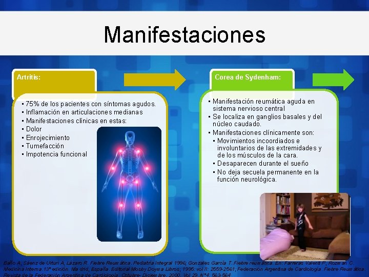 Manifestaciones Artritis: • • 75% de los pacientes con síntomas agudos. Inflamación en articulaciones