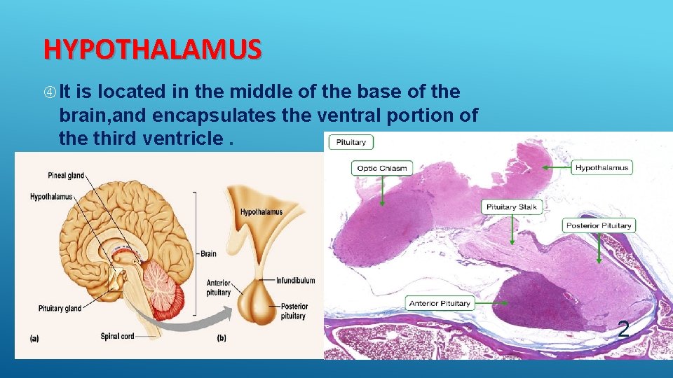HYPOTHALAMUS It is located in the middle of the base of the brain, and