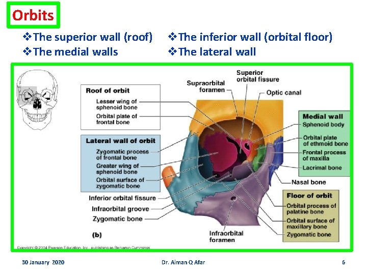 Orbits v. The superior wall (roof) v. The medial walls 30 January 2020 v.