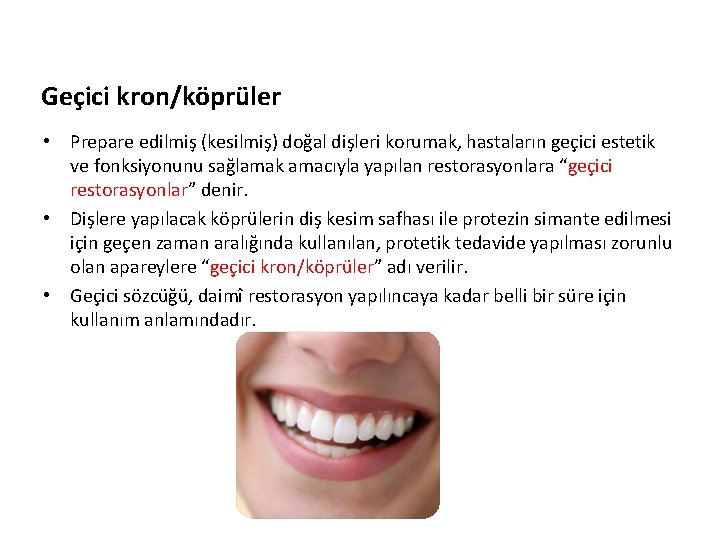 Geçici kron/köprüler • Prepare edilmiş (kesilmiş) doğal dişleri korumak, hastaların geçici estetik ve fonksiyonunu