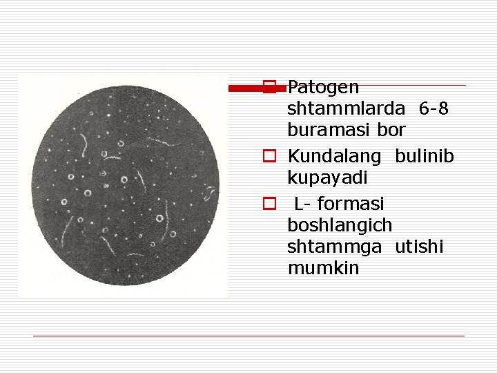 o Patogen shtammlarda 6 -8 buramasi bor o Kundalang bulinib kupayadi o L- formasi
