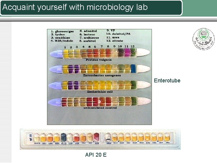 Acquaint yourself with microbiology lab Enterotube API 20 E 