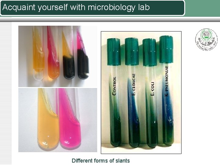 Acquaint yourself with microbiology lab Different forms of slants 