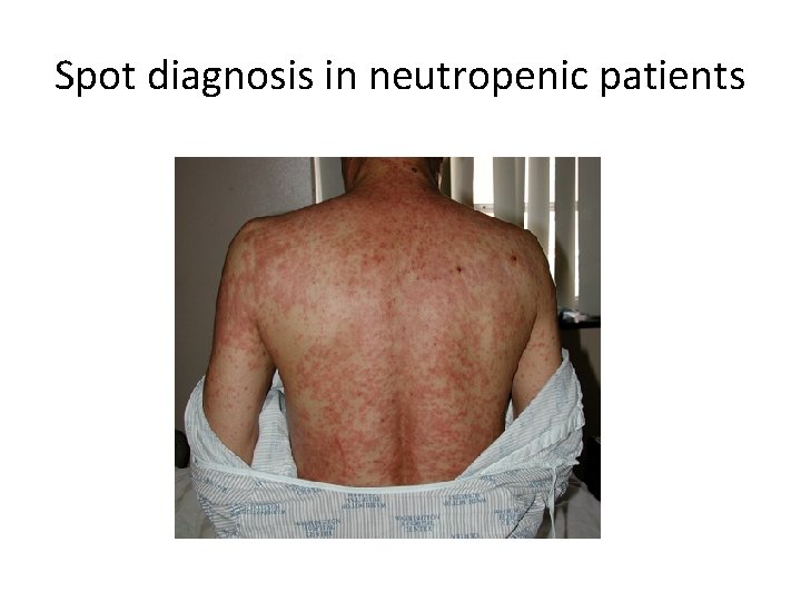 Spot diagnosis in neutropenic patients 