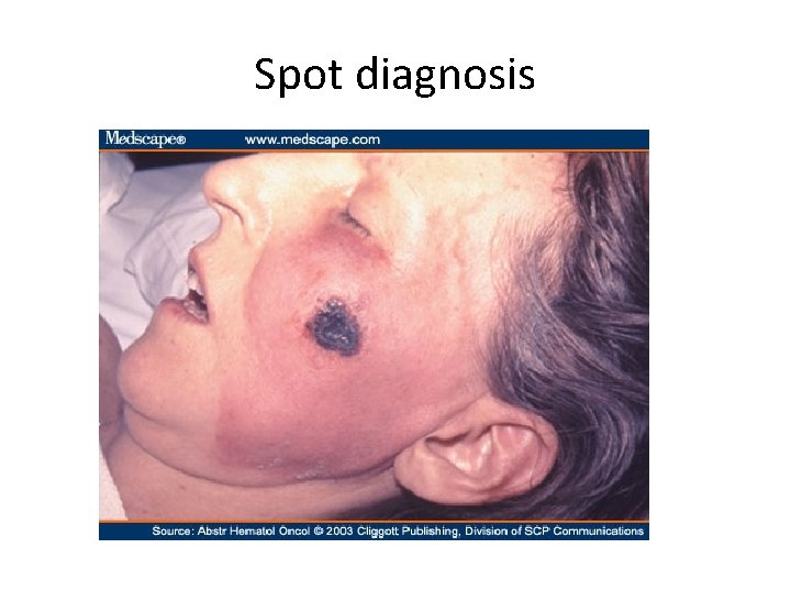 Spot diagnosis 