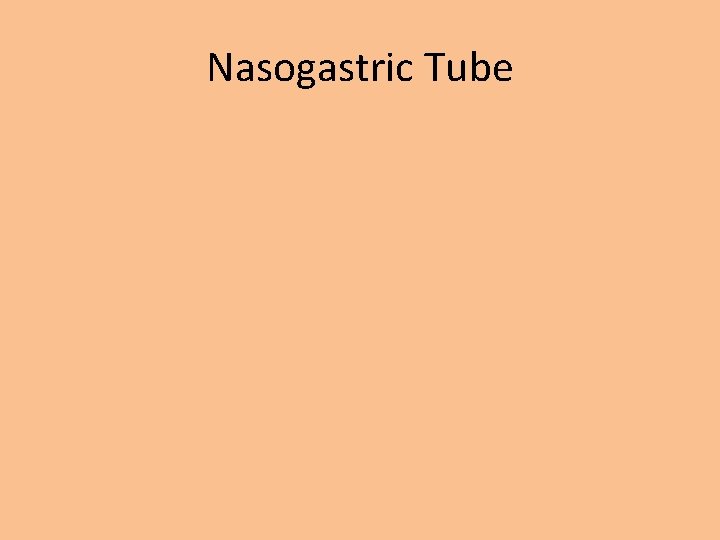 Nasogastric Tube 