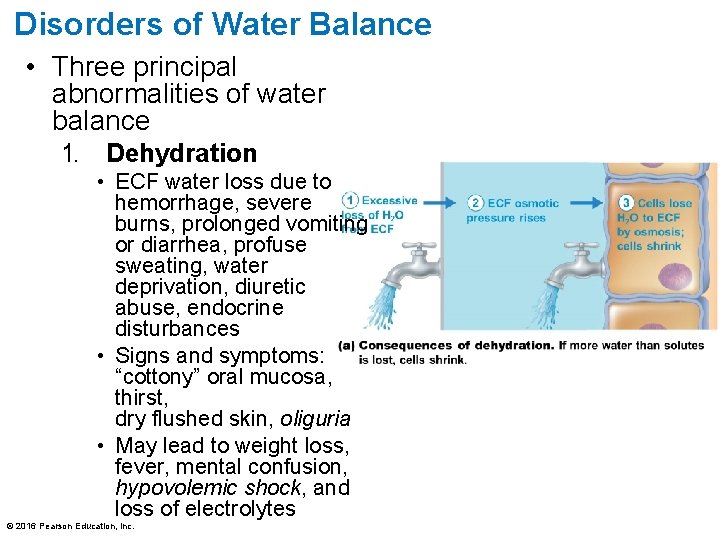 Disorders of Water Balance • Three principal abnormalities of water balance 1. Dehydration •