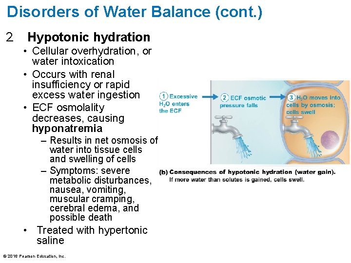 Disorders of Water Balance (cont. ) 2. Hypotonic hydration • Cellular overhydration, or water