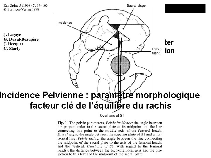 Incidence Pelvienne : paramètre morphologique facteur clé de l’équilibre du rachis 
