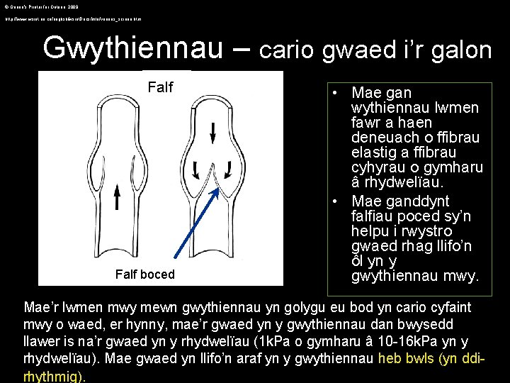 © Queen's Printer for Ontario, 2009 http: //www. wsiat. on. ca/english/wsiat. Docs/mlo/venous_screen. htm Gwythiennau