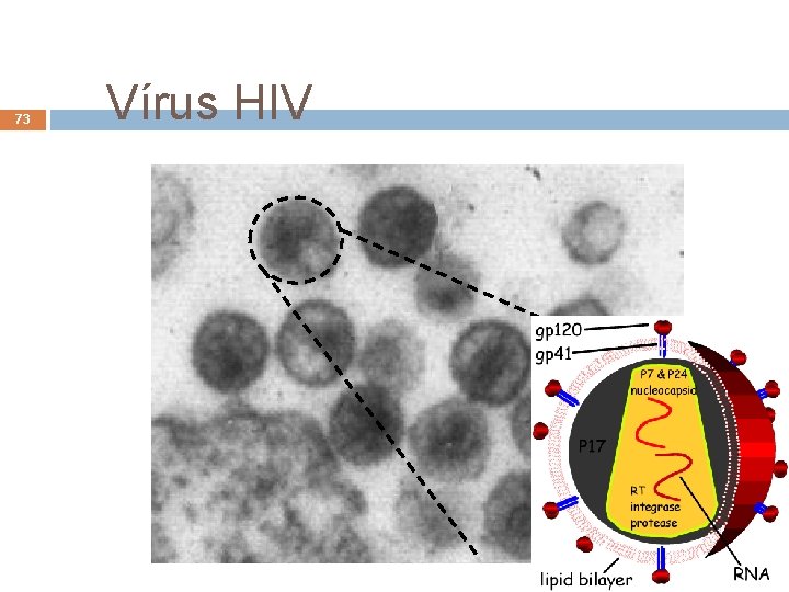 73 Vírus HIV André de Carvalho - ICMC/USP 15/06/2021 