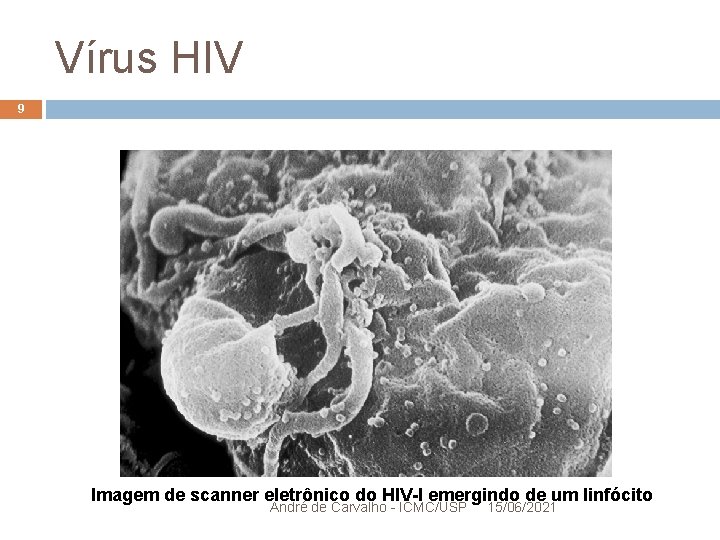 Vírus HIV 9 Imagem de scanner eletrônico do HIV-I emergindo de um linfócito André