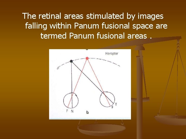 The retinal areas stimulated by images falling within Panum fusional space are termed Panum