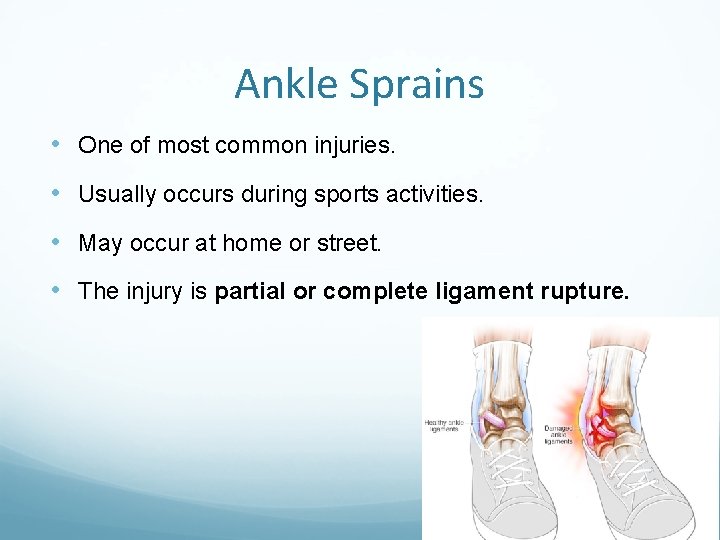 Ankle Sprains • One of most common injuries. • Usually occurs during sports activities.