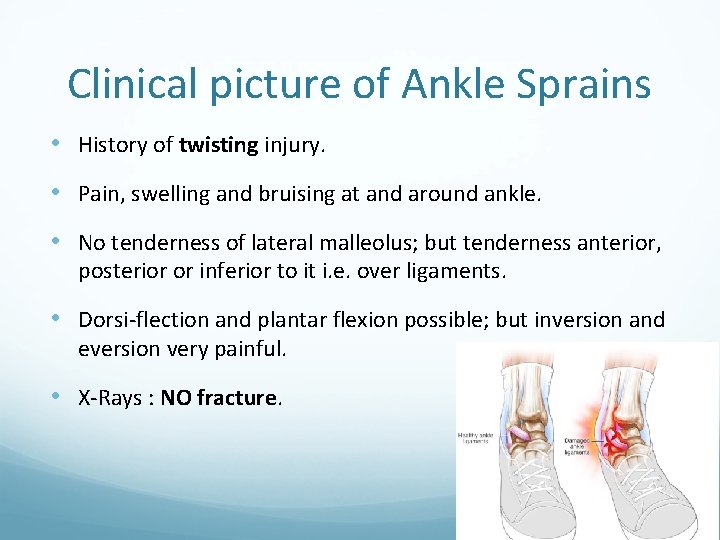 Clinical picture of Ankle Sprains • History of twisting injury. • Pain, swelling and