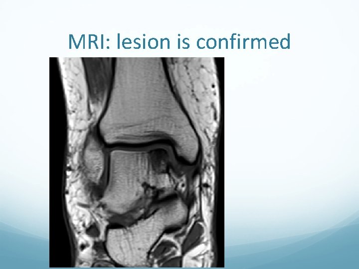 MRI: lesion is confirmed 