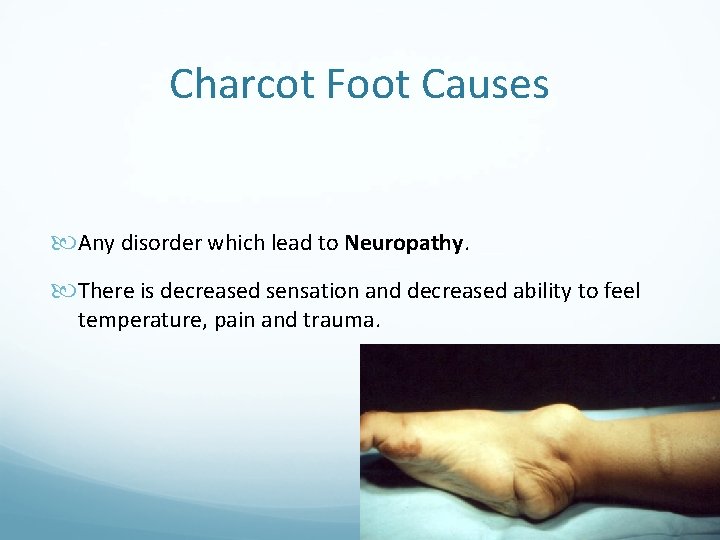 Charcot Foot Causes Any disorder which lead to Neuropathy. There is decreased sensation and