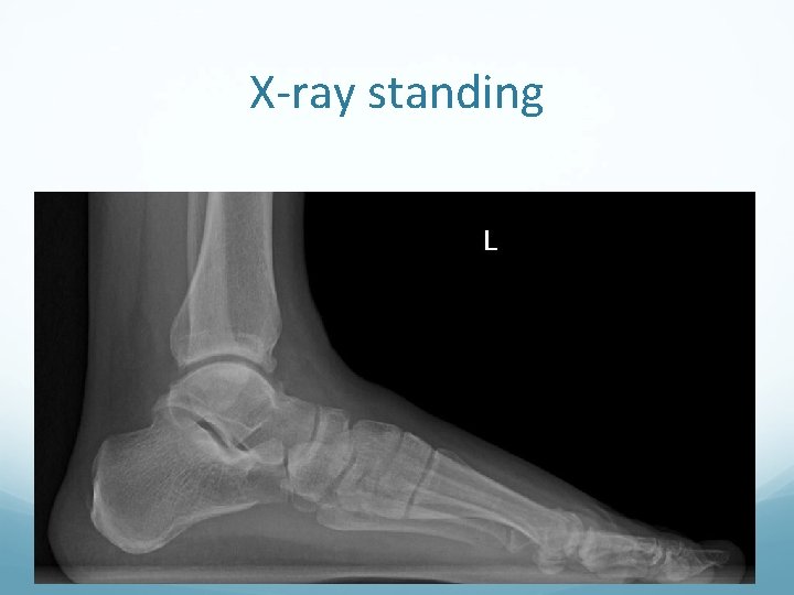 X-ray standing 