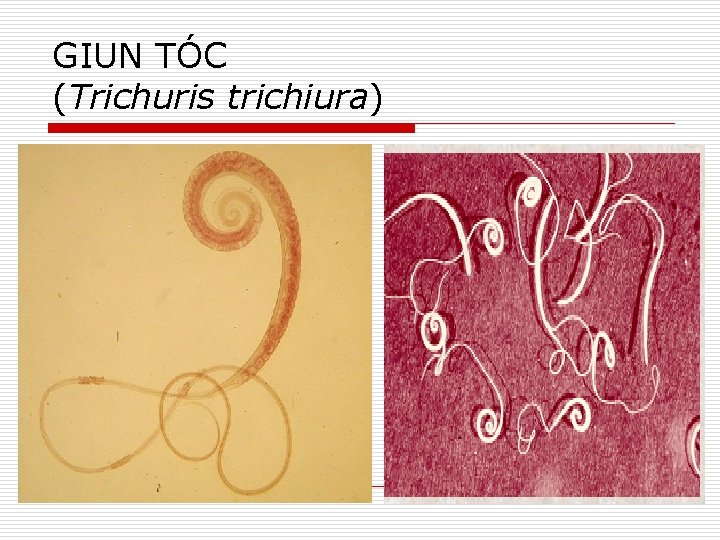 GIUN TÓC (Trichuris trichiura) 