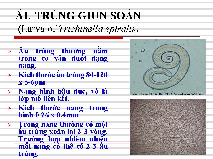 ẤU TRÙNG GIUN SOẮN (Larva of Trichinella spiralis) Ø Ø Ø Ấu trùng thường