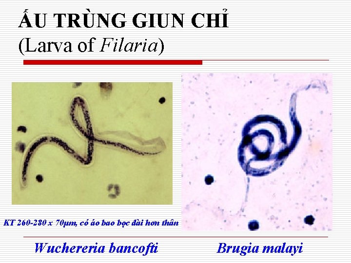 ẤU TRÙNG GIUN CHỈ (Larva of Filaria) KT 260 -280 x 70µm, có áo
