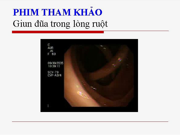 PHIM THAM KHẢO Giun đũa trong lòng ruột 