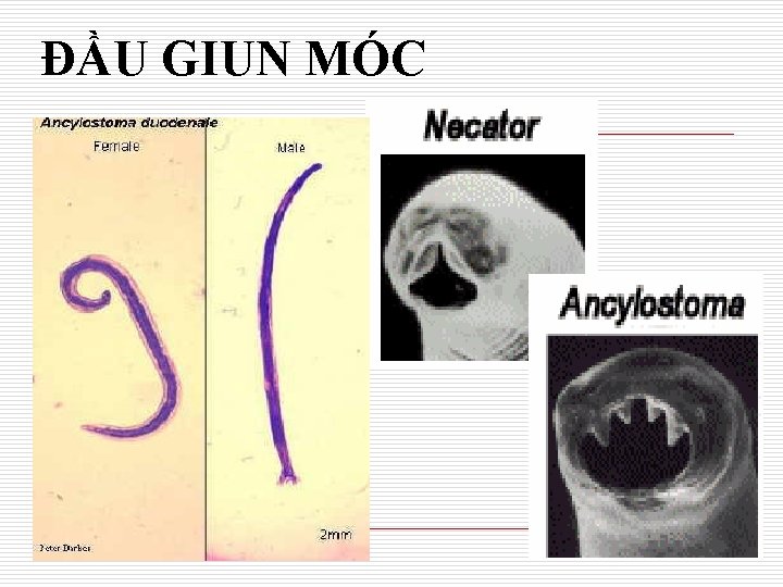 ĐẦU GIUN MÓC 