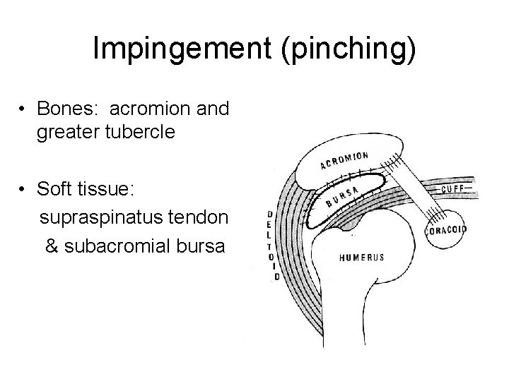 Impingement (pinching) • Bones: acromion and greater tubercle • Soft tissue: supraspinatus tendon &