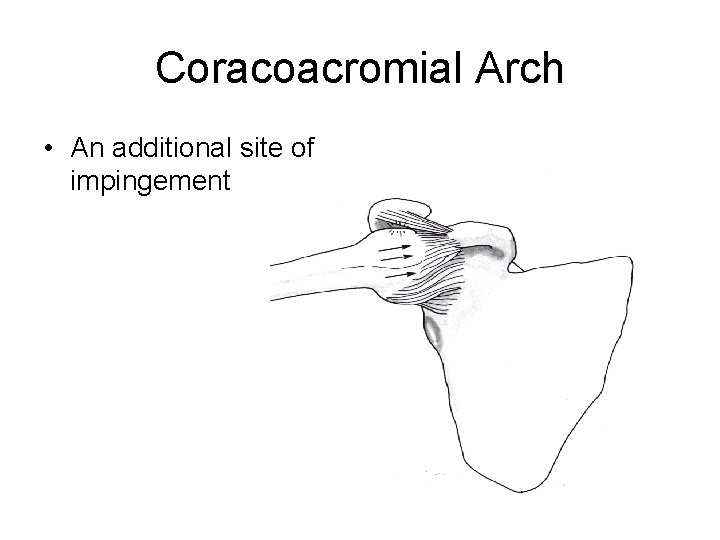 Coracoacromial Arch • An additional site of impingement 