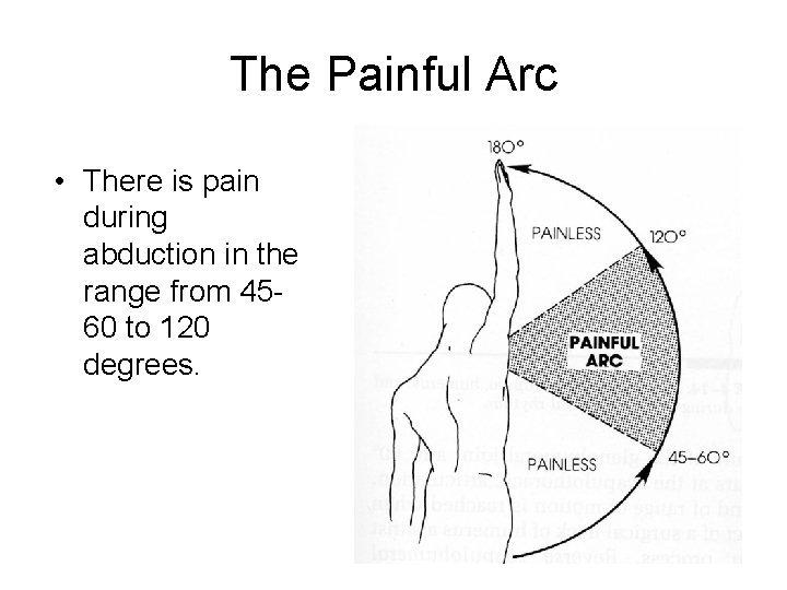 The Painful Arc • There is pain during abduction in the range from 4560