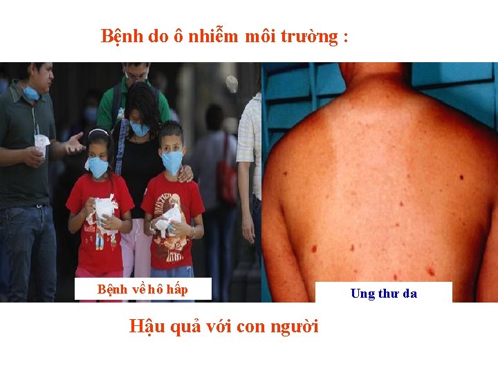 Bệnh do ô nhiễm môi trường : Bệnh về hô hấp Hậu quả với