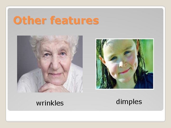 Other features wrinkles dimples 