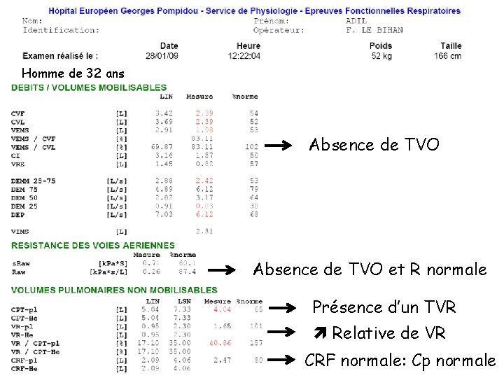 Homme de 32 ans Absence de TVO et R normale Présence d’un TVR Relative