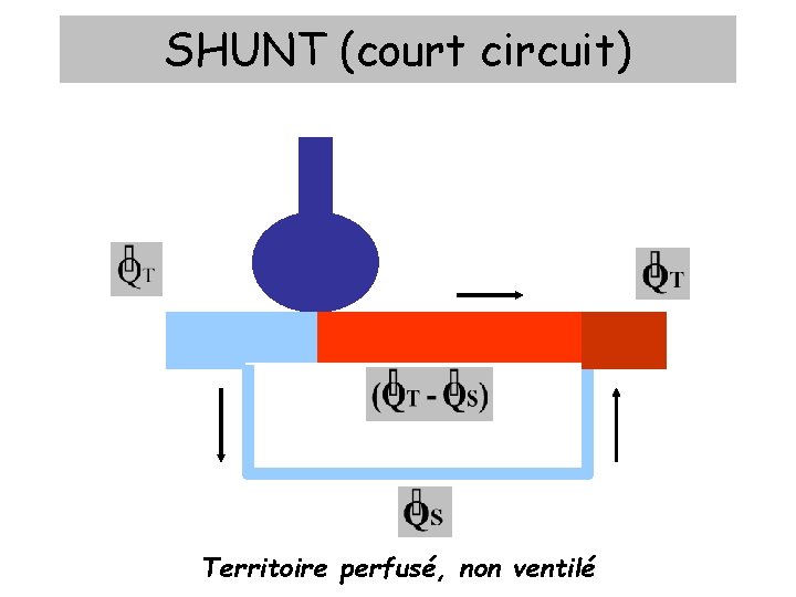 SHUNT (court circuit) Territoire perfusé, non ventilé 