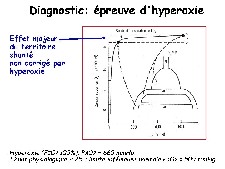 Diagnostic: épreuve d'hyperoxie Effet majeur du territoire shunté non corrigé par hyperoxie Hyperoxie (FIO