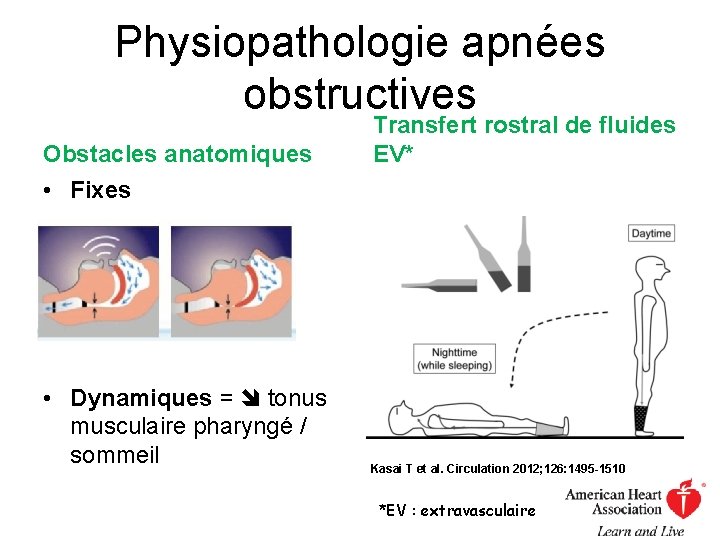 Physiopathologie apnées obstructives Obstacles anatomiques Transfert rostral de fluides EV* • Fixes • Dynamiques