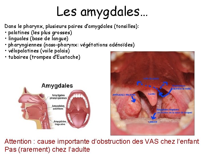 Les amygdales… Dans le pharynx, plusieurs paires d’amygdales (tonsilles): • palatines (les plus grosses)