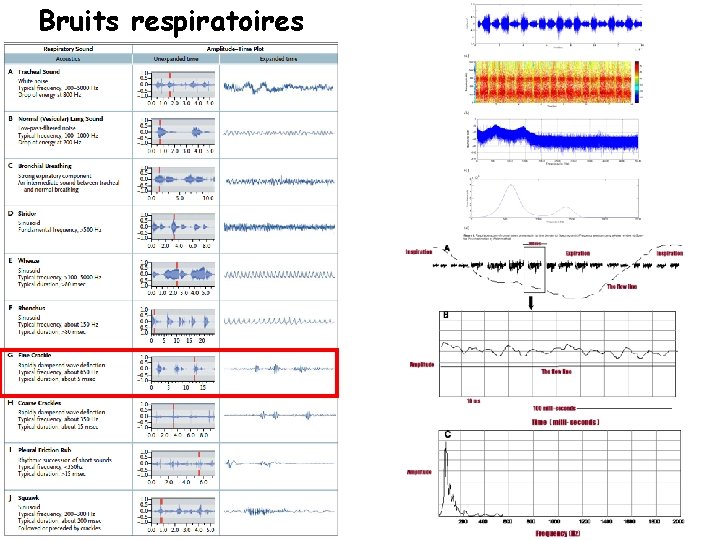 Bruits respiratoires 