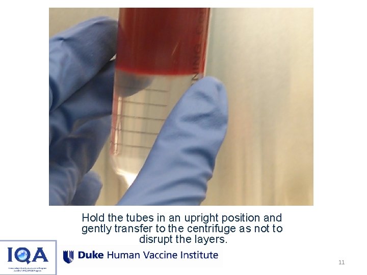Hold the tubes in an upright position and gently transfer to the centrifuge as