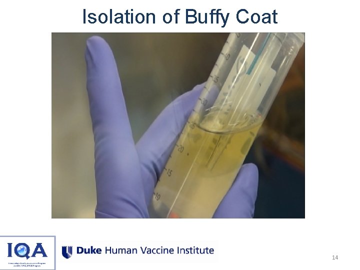 Isolation of Buffy Coat 14 