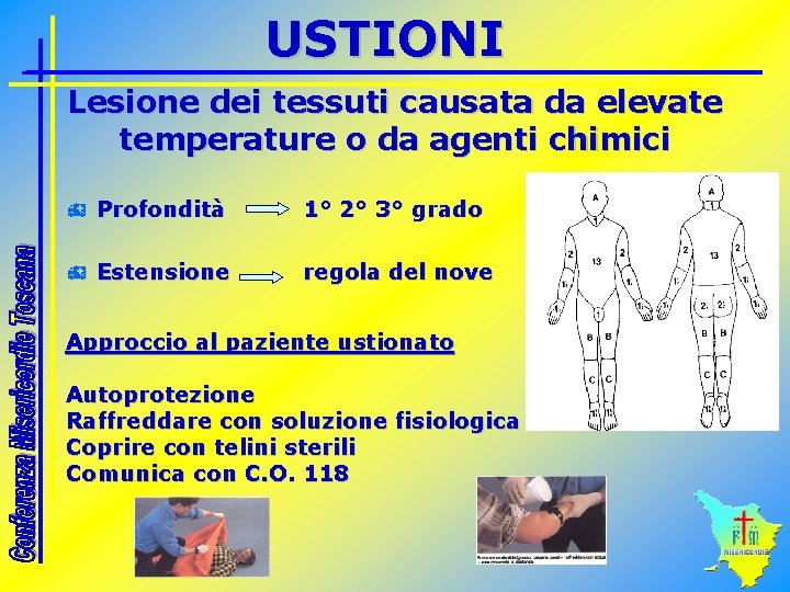 USTIONI Lesione dei tessuti causata da elevate temperature o da agenti chimici h Profondità