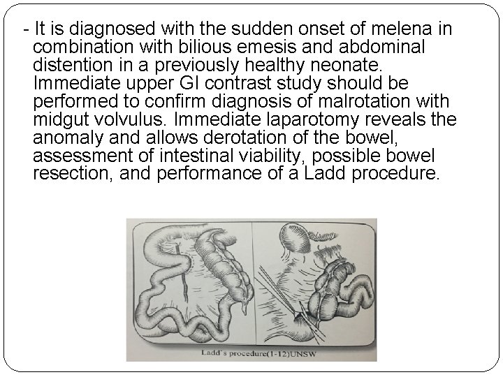 - It is diagnosed with the sudden onset of melena in combination with bilious