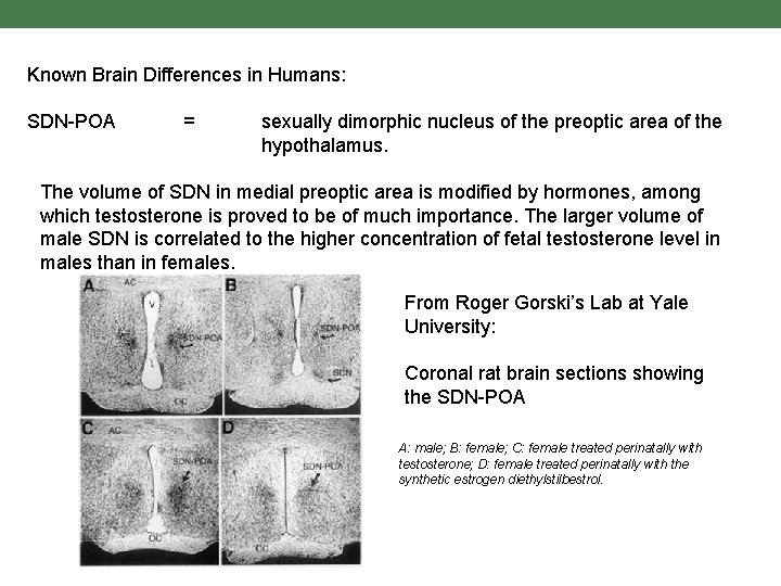 Known Brain Differences in Humans: SDN-POA = sexually dimorphic nucleus of the preoptic area