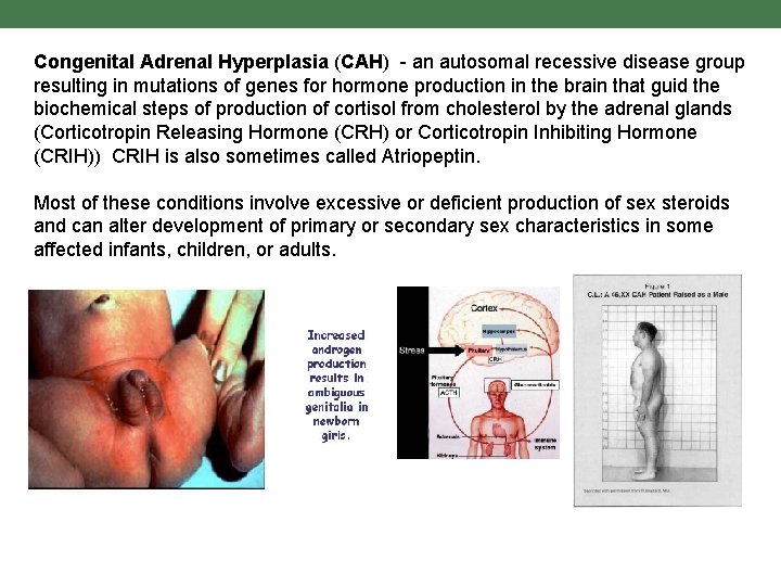 Congenital Adrenal Hyperplasia (CAH) - an autosomal recessive disease group resulting in mutations of