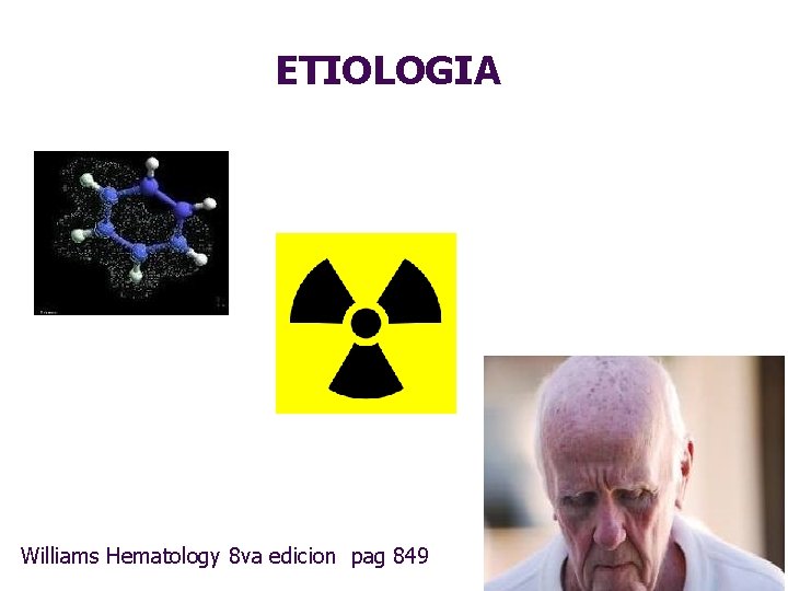 ETIOLOGIA Williams 1/15/2022 Hematology 8 va edicion pag 849 