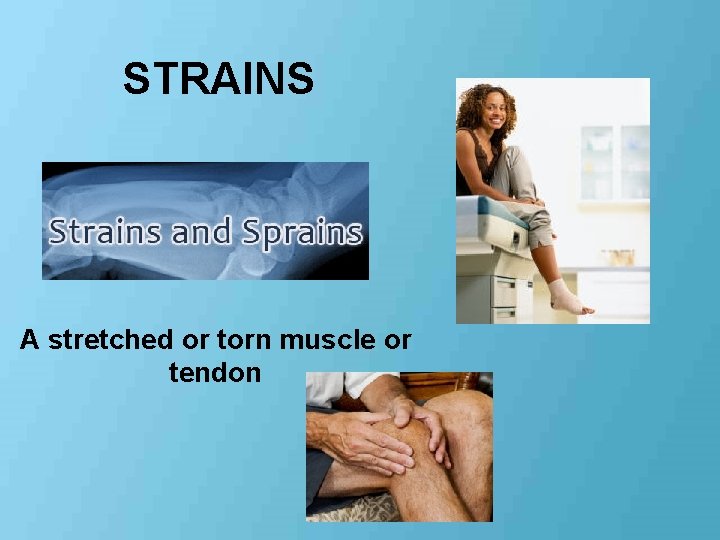 STRAINS A stretched or torn muscle or tendon 