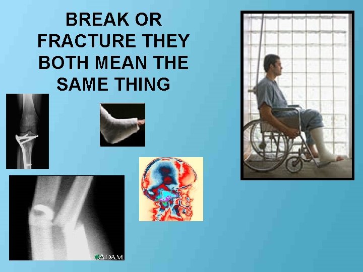 BREAK OR FRACTURE THEY BOTH MEAN THE SAME THING 