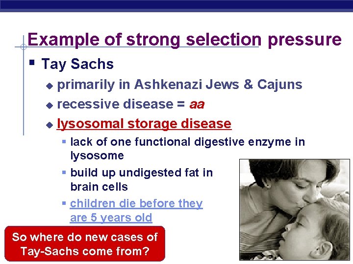Example of strong selection pressure § Tay Sachs primarily in Ashkenazi Jews & Cajuns Example of strong selection pressure § Tay Sachs primarily in Ashkenazi Jews & Cajuns