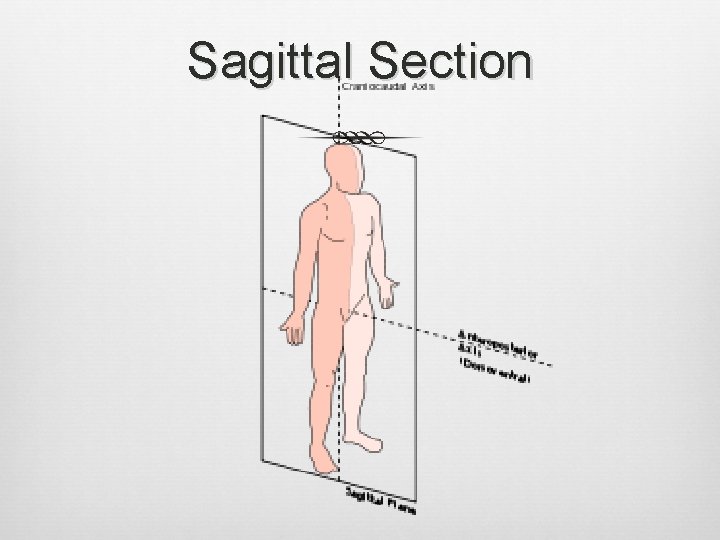 Sagittal Section 
