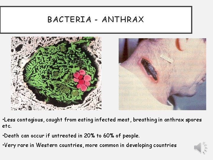 BACTERIA - ANTHRAX • Less contagious, caught from eating infected meat, breathing in anthrax